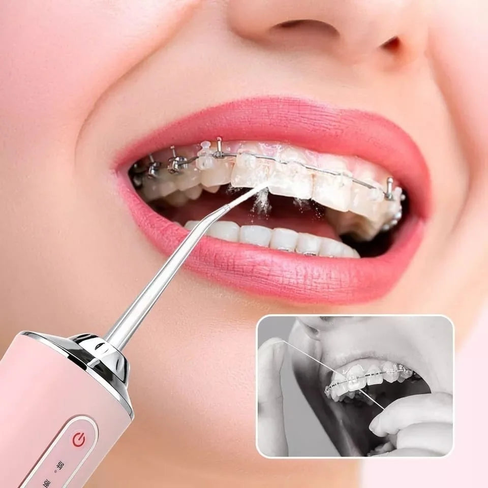 Irrigador Dental Oral Portátil Recarregável UB 220ml Promoção Limpeza …